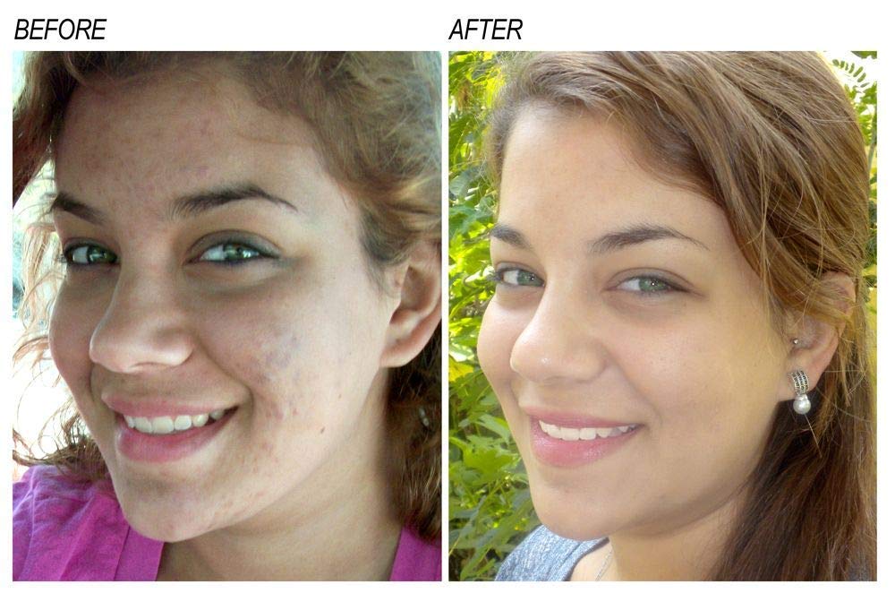 Neoprosone Brightening Serum with Vitamin 